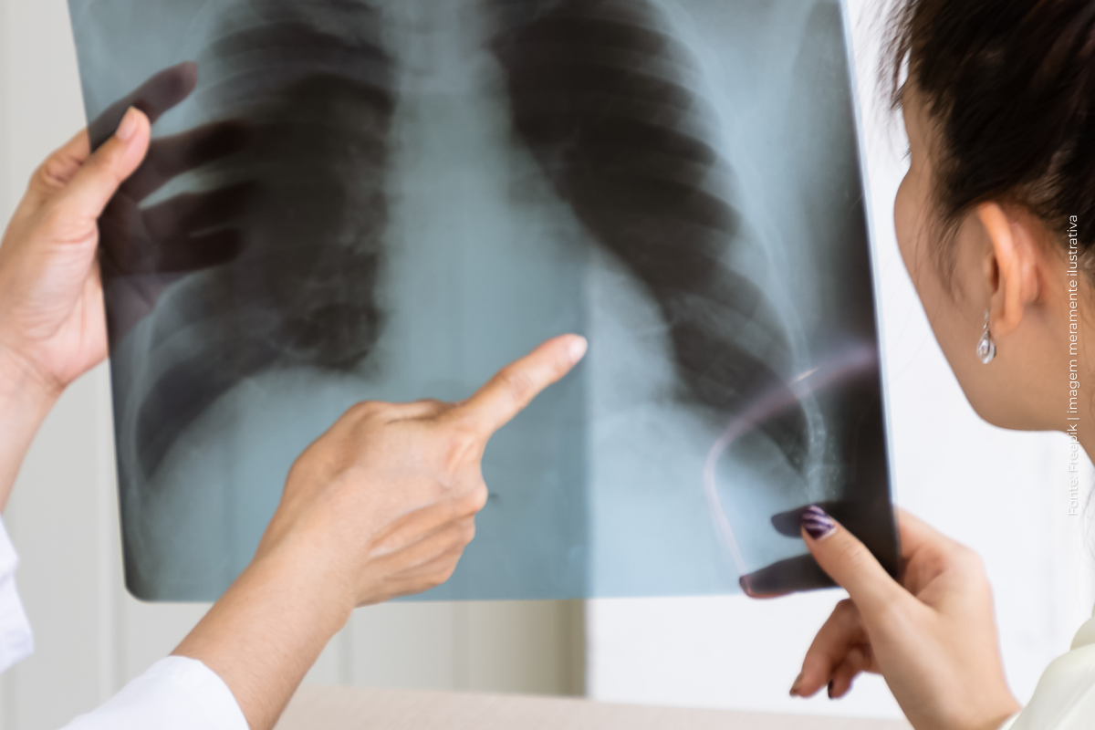 Estado terá política de apoio a familiares de pessoas com tuberculose