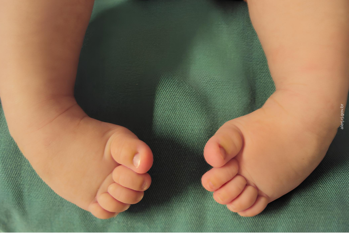 Agora é Lei: Exame para diagnóstico do pé torto congênito em recém-nascidos deverá ser oferecido em hospitais públicos Agora é Lei: Exame para diagnóstico do pé torto congênito em recém-nascidos deverá ser oferecido em hospitais públicos
