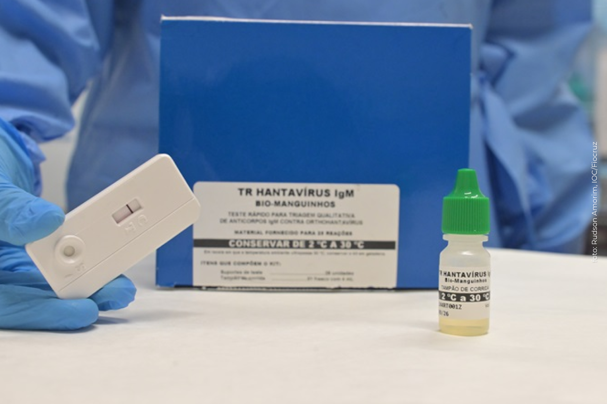 Fiocruz e UFRJ desenvolvem novo teste rápido para hantavirose