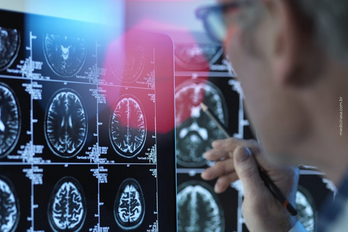 Bactérias na boca e no intestino podem estar relacionadas a aneurismas