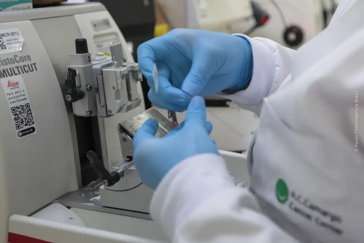 SUS inclui nova terapia para pacientes adultos com leucemia mieloide