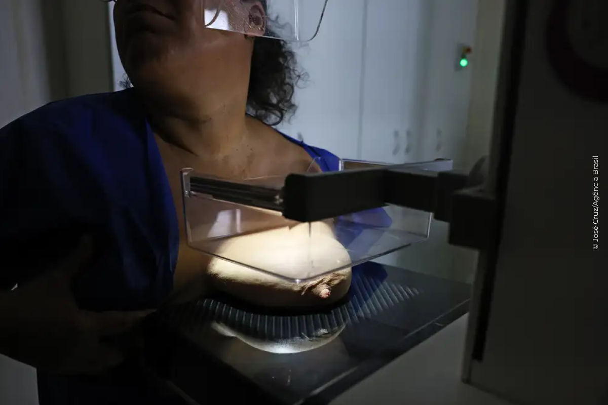 ANS defende que plano cubra mamografia digital sem restrição de idade
