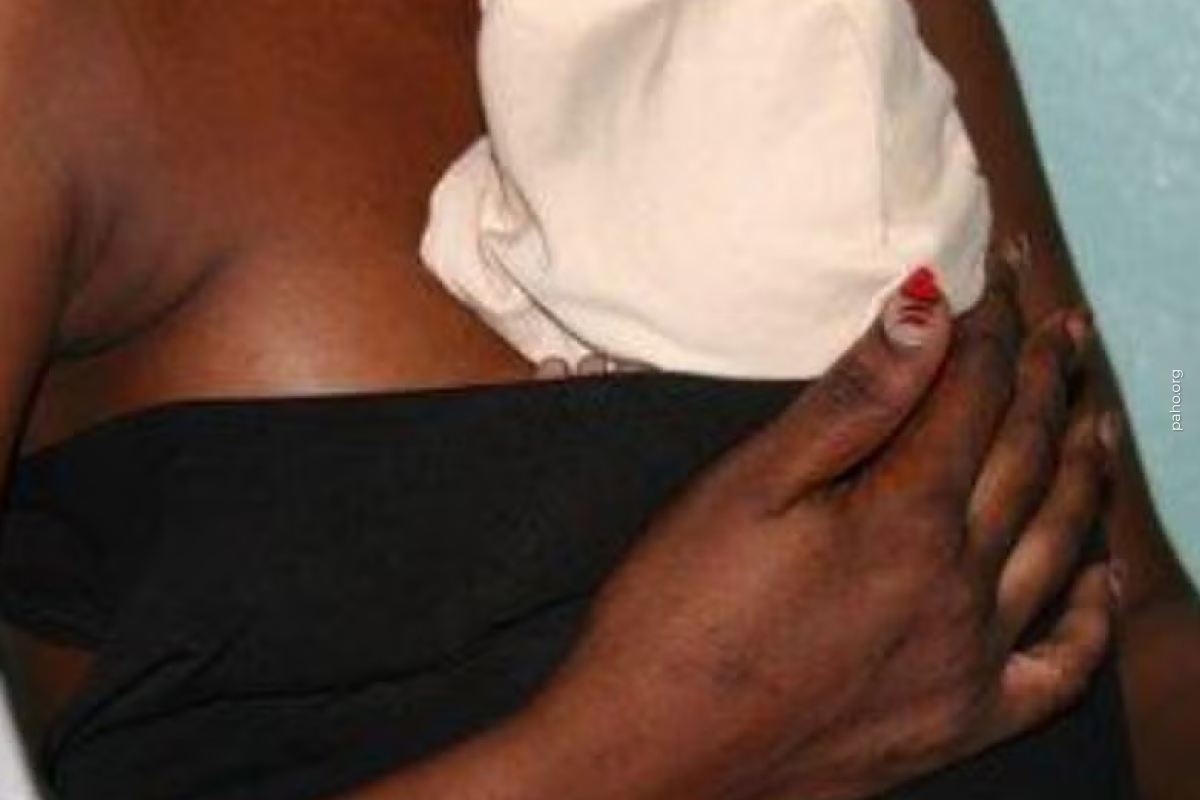 OMS chama à ampliação da triagem neonatal para melhorar detecção precoce e cuidado de anomalias congênitas