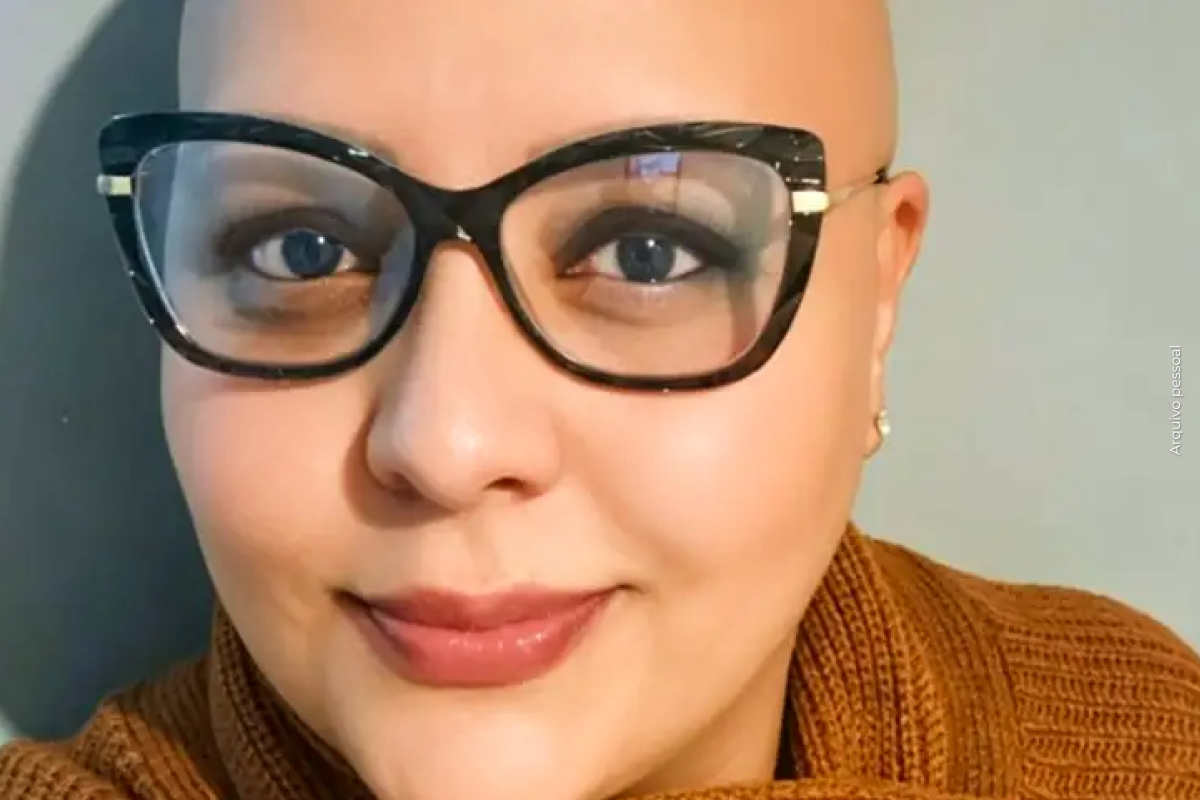 Pacientes com alopecia areata contam trajetória para reaver autoestima Pacientes com alopecia areata contam trajetória para reaver autoestima